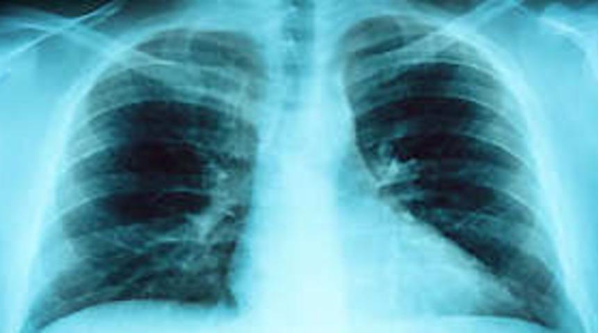 Ağrısız ve sancısız akciğer testi