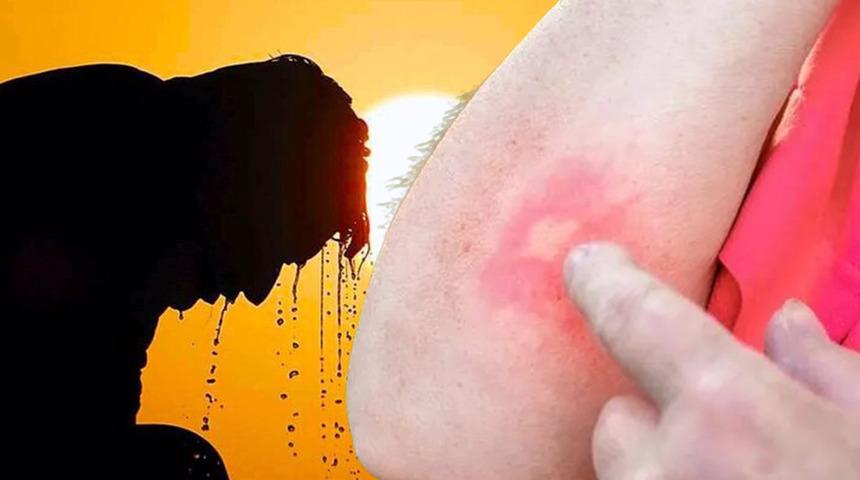 Aman dikkat! Yaz aylarında ortaya çıkıyor, gördüğünüz an kaçın: "Felç olabilirsiniz"