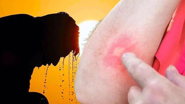 Aman dikkat! Yaz aylarında ortaya çıkıyor, gördüğünüz an kaçın: Felç olabilirsiniz