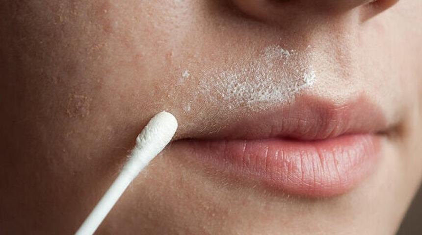 Bu tarif lazerden daha etkili! Sadece bir avuç kullanıp yüzünüzdeki tüylere veda edin