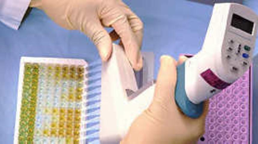 Bilerek AİDS bulaştırmaya 7 yıl hapis