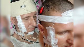 İnternette beyin cerrahlarını izledi: Rüyalarını kontrol etmek için kafasını matkapla delip çip yerleştirdi! 1 litre kan kaybettim...