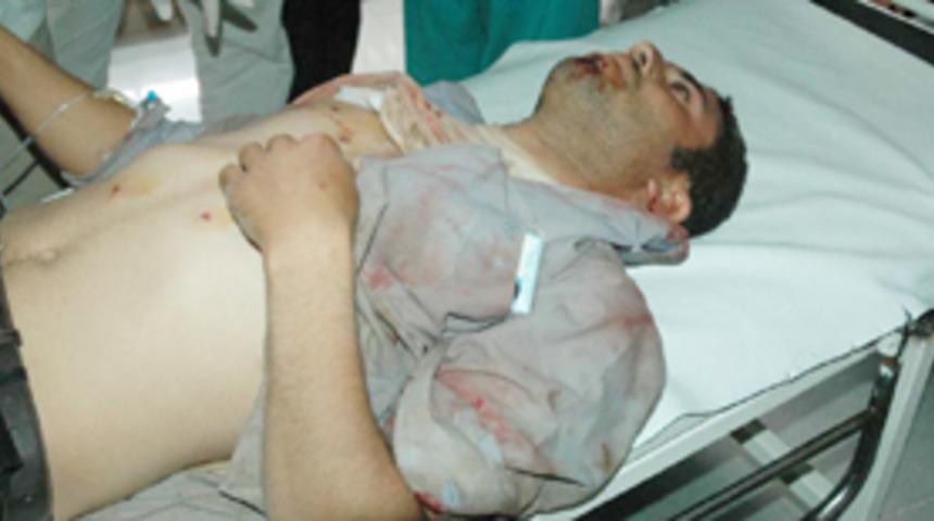 K&ouml;yde meydan kavgası: 40 yaralı