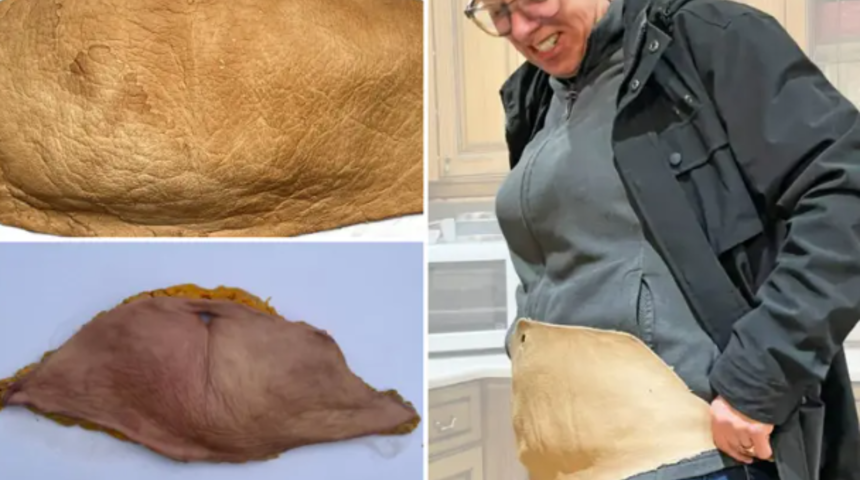 Göbeğinin bir kısmını aldırıp sanat eserine dönüştürdü! 2 kilogramlık deriyi öyle bir hale getirdi ki...