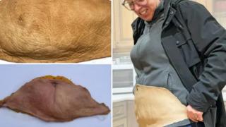 Göbeğinin bir kısmını aldırıp sanat eserine dönüştürdü! 2 kilogramlık deriyi öyle bir hale getirdi ki...