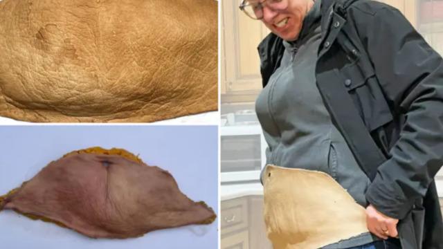 Göbeğinin bir kısmını aldırıp sanat eserine dönüştürdü! 2 kilogramlık deriyi öyle bir hale getirdi ki...