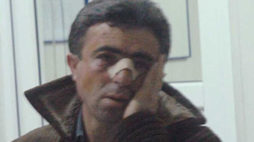 Tacizciye meydan dayağı