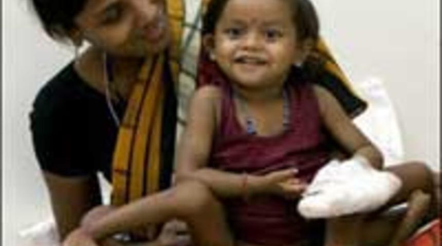 4 bacaklı ve 4 kollu kızın dramı