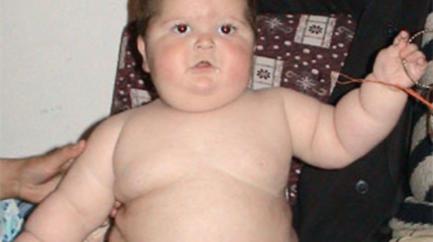 Çocukluk obezitesinde aile riski