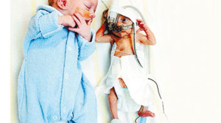 Bunlar ne bi&ccedil;im ikiz?