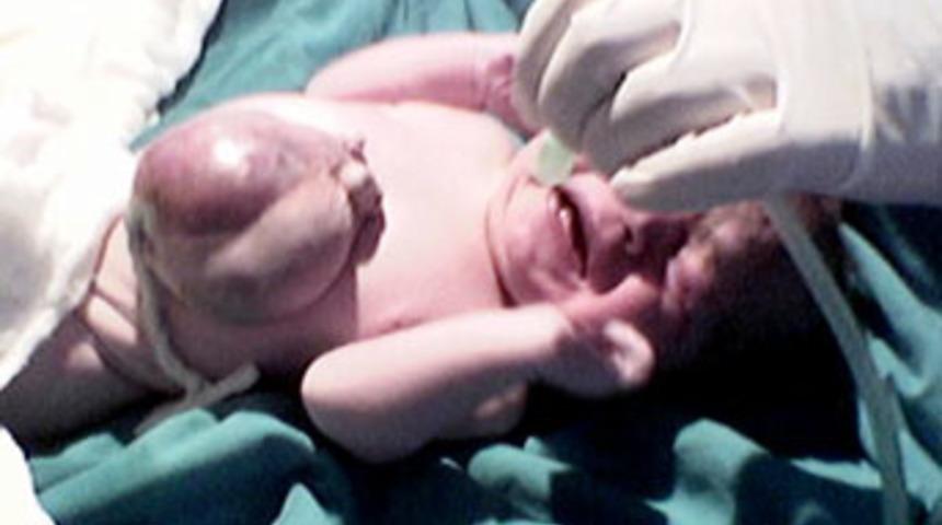 Kalbi dışarıda doğdu