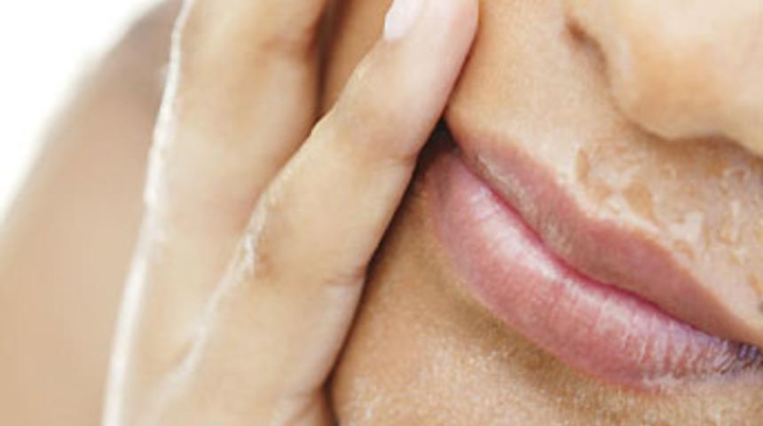 Ağızdaki her yara "Behçet hastası" değildir