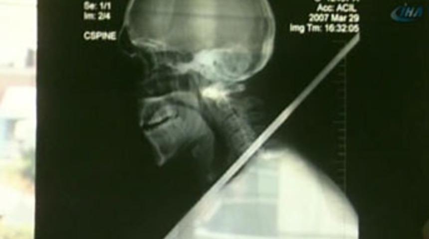 İnşaatta korkun&ccedil; iş kazası