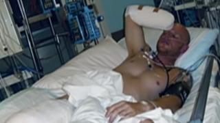 Köpek balığı saldırısını saniye saniye anlattı! “Kendi kanımda boğulacaktım, 350 diş birden saplandı”