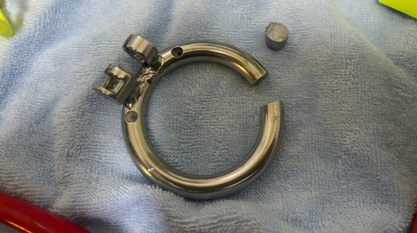 Cinsel organına taktığı çelik halkayı çıkartamayınca hastanelik oldu! İki saatlik operasyonla kurtuldu