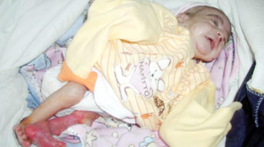 V&uuml;cudu yanan bebeği kar &uuml;zerine bıraktılar