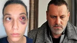 Ozan Güven ve Deniz Bulutsuz davasında flaş gelişme! Beklenen rapor çıktı