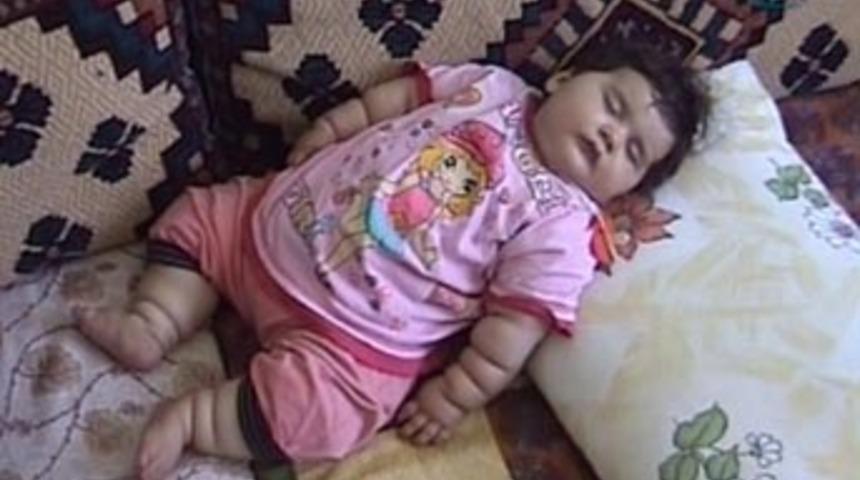 7 aylık bebek 14 kiloya ulaştı