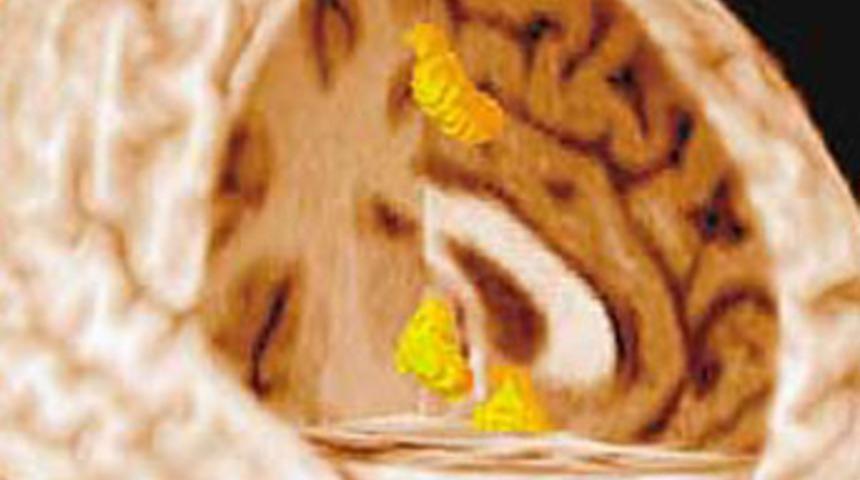 Unutkanlığı &ouml;nleyen besinler