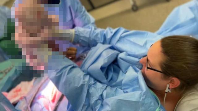 Sosyal medyanın yeni trendi! Anneler sezaryan doğum sırasında bebeklerini kendileri çıkartıyorlar 