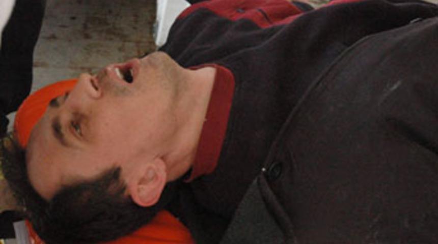 &Ouml;l&uuml;mden son anda kurtuldu