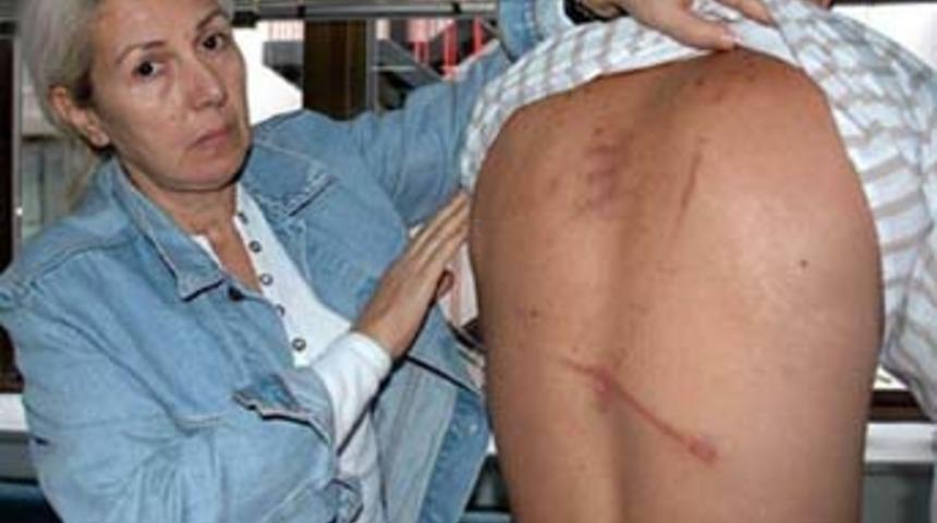 Bayramda "i&ccedil;ki i&ccedil;en gen&ccedil;lere polis dayağı" iddiası