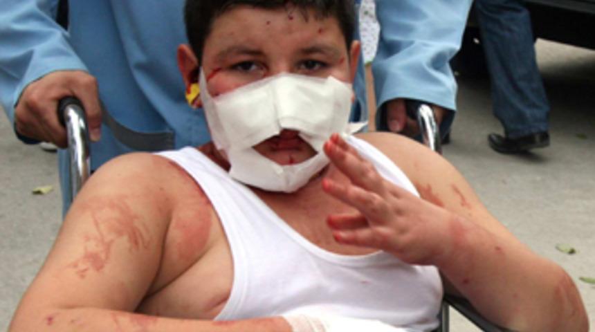 Bursa'da maytap faciası