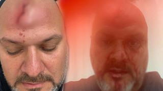 Yer: İstanbul! 100 bin lira kira talebini reddetti, kanlar içinde kaldı: Beyzbol sopasıyla saldırdılar