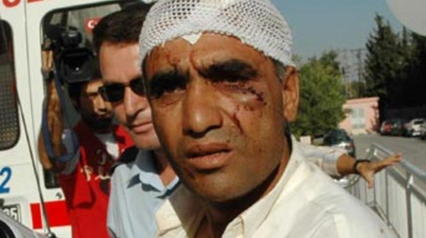 Karısını 27 yerinden bı&ccedil;akladı