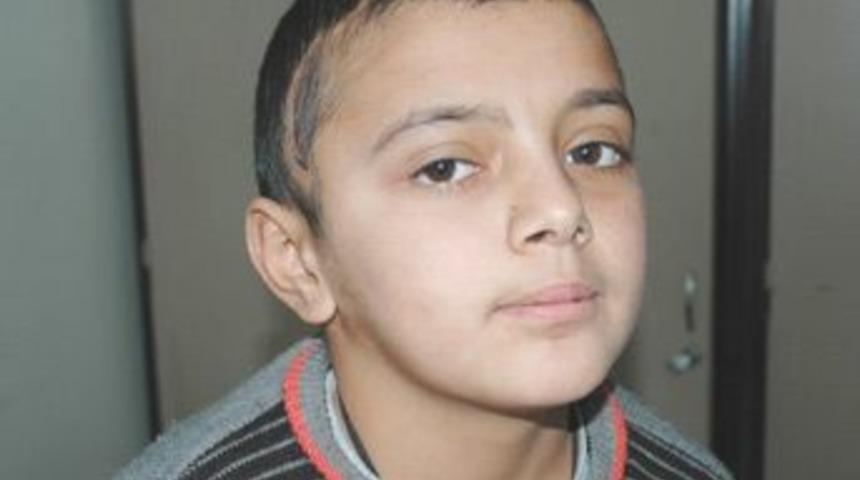 Kafasında 5 dikiş iğnesiyle yaşıyor