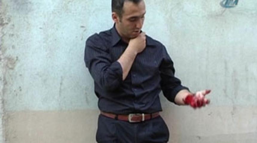 &Ccedil;ılgın aşık intihara kalkıştı