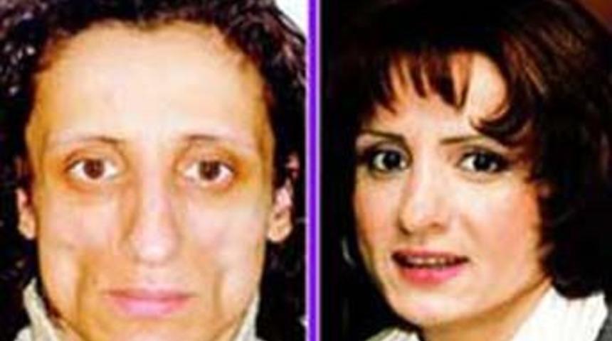 Kocası "maymun gibisin" dedi hayatı değişti