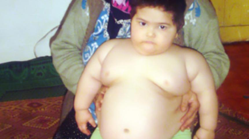 3 yaşında 40 kilo