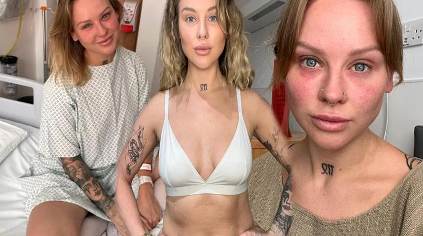 Estetik ameliyattan sonra kabusu yaşadı! Bir anda gözleri kör oldu... “Yavaş yavaş ölüyormuş gibi hissettim”