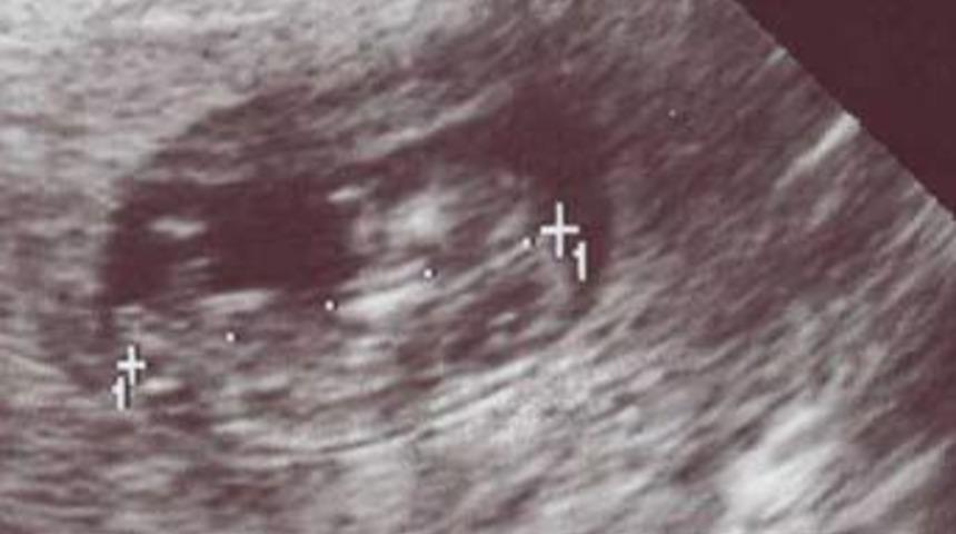 Bebeğin cinsiyetini &ouml;ğrenmenin 40 yolu