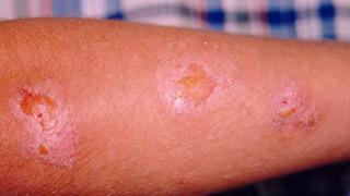 Sıcak havalarda herkes onlardan şikayetçi... Uzman isim uyardı! Hastalıklara neden oluyor 'Bitirilemez ama...'