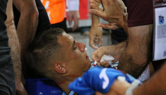 Trabzonspor’da Filip Benkovic’in burnu kırıldı!Trabzonspor