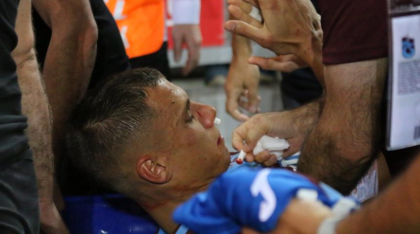 Trabzonspor'da Filip Benkovic'in burnu kırıldı!