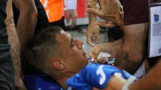 Trabzonspor'da Filip Benkovic'in burnu kırıldı!