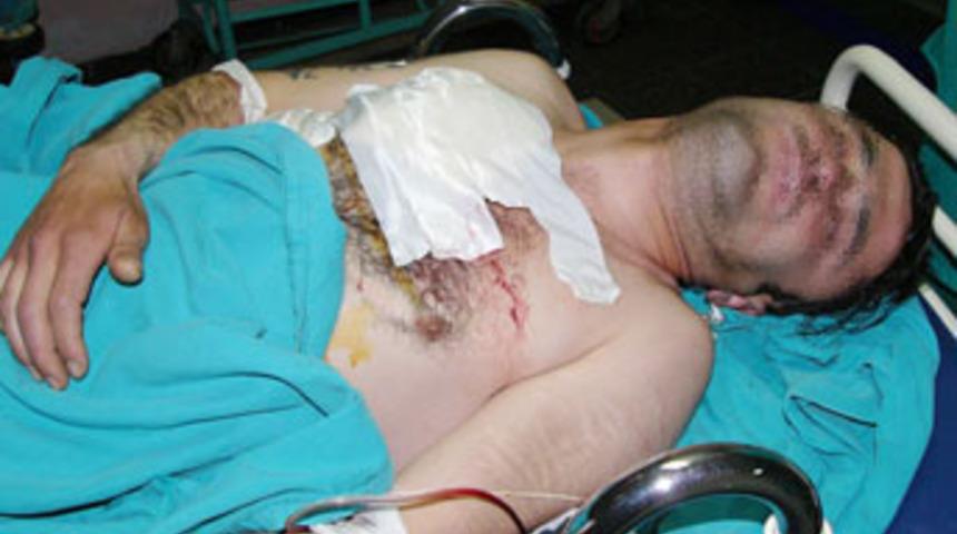 Akıl hastası yoldan ge&ccedil;en kişiyi bı&ccedil;akladı