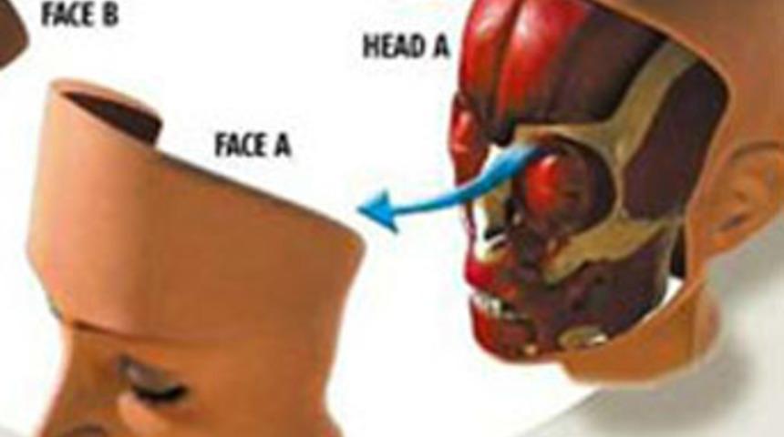 Fransa'da ikinci y&uuml;z nakli