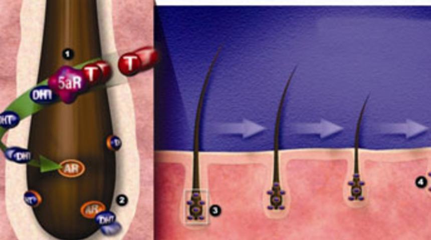 Sa&ccedil; d&ouml;k&uuml;lmesi sorununuz mu var?