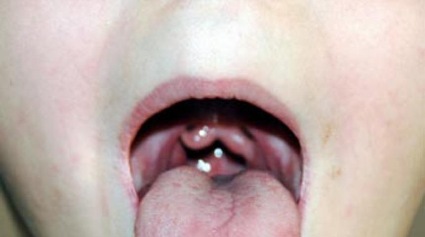 &Ccedil;atal dilli &ccedil;ocuk g&ouml;renleri şaşırtıyor