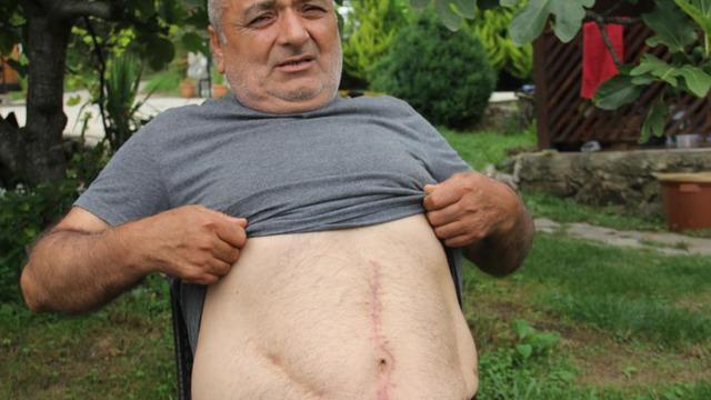 Yıllardır karın ağrısı yaşıyordu, gerçek 18 yıl sonra ortaya çıktı: 'Yüzde 73 engelli haline geldim'