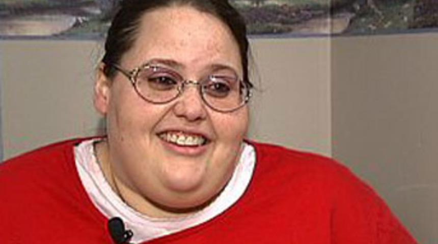 ABD'de bir kadından 42 kilo ur &ccedil;ıkarıldı