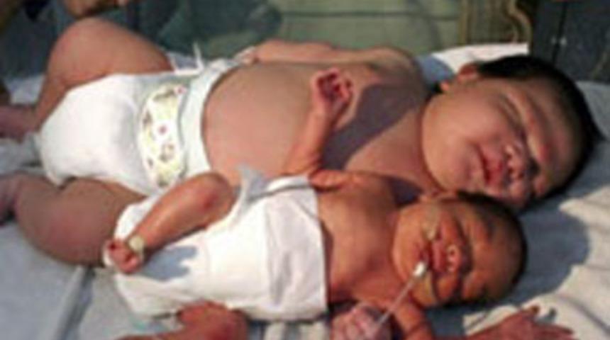 6.5 kiloluk bebek doğdu