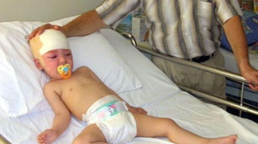 18 aylık bebeğin beyninin bir kısmı alındı