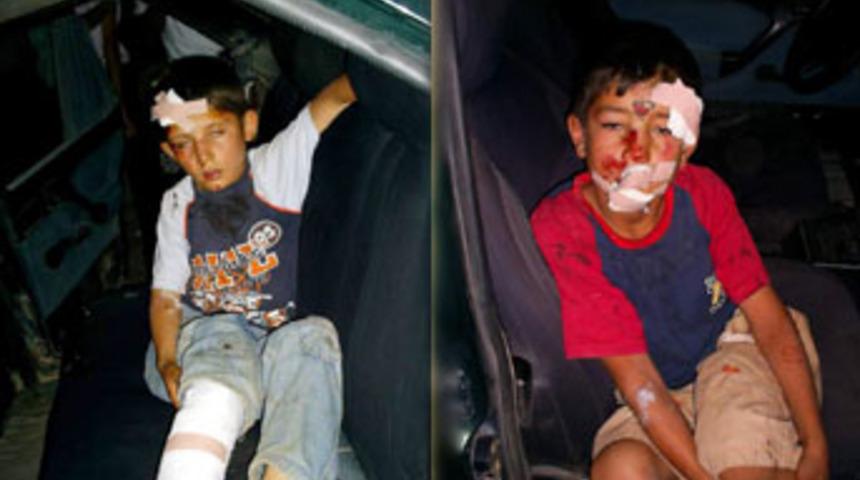 Alkoll&uuml; şahıslar 2 &ccedil;ocuğu hastanelik etti