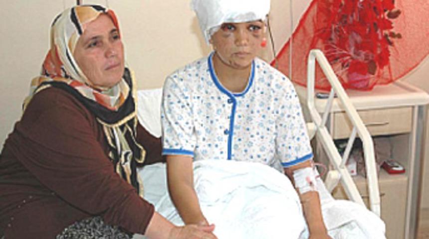 Sa&ccedil;larını vantilat&ouml;re kaptırınca kafa derisi y&uuml;z&uuml;ld&uuml;