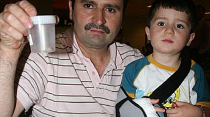 &Ccedil;ocuğun parmağı u&ccedil;akta koptu